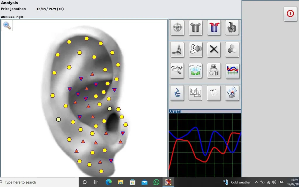 GR Metapathia screen displaying a detailed right auricle bioresonance scan.