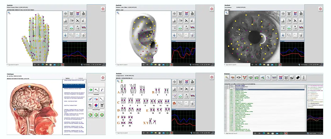 Collage of Metapathia GR bioresonance software screens from the Metatron Hunter 4025 NLS Verified system showing non-invasive biofeedback interface displays.
